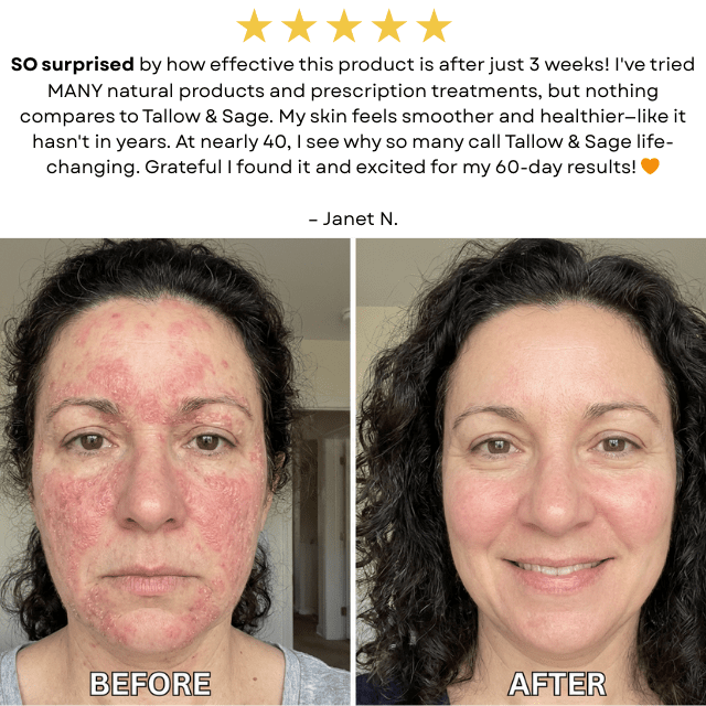 The Ancestral Skin Repair System - Tallow & Sage